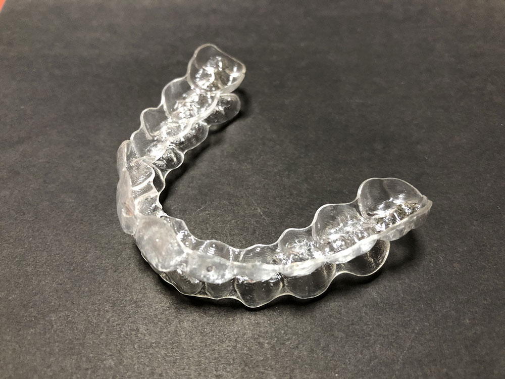 マウスピース矯正